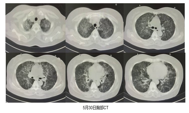 病情危急 快速响应转诊